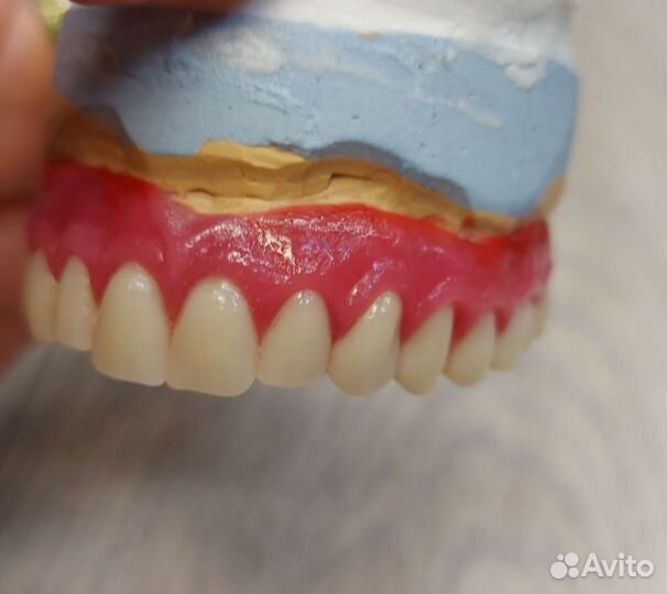 Починки зубных протезов