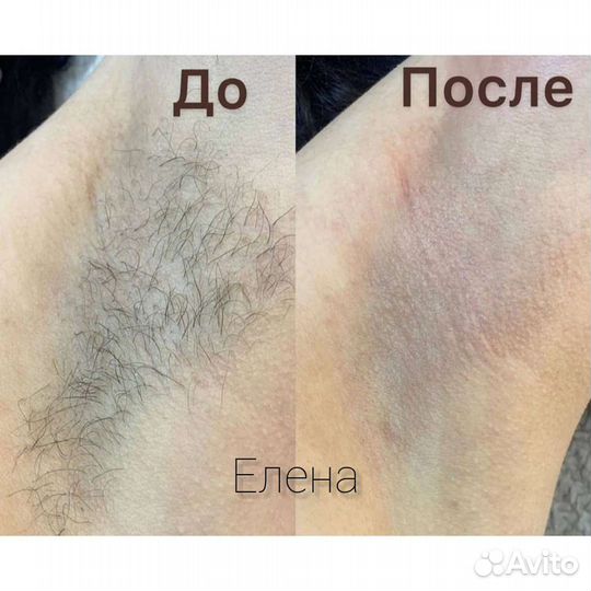 Красота
