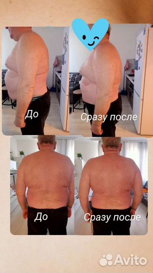 Массаж общий/ лечебный /антицеллюлитный/спортивный