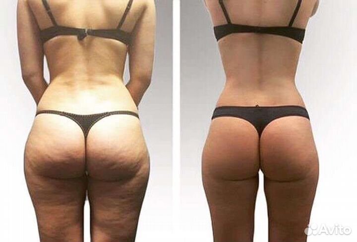 Коррекция фигуры - массаж лица и тела