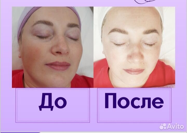 Косметологические услуги