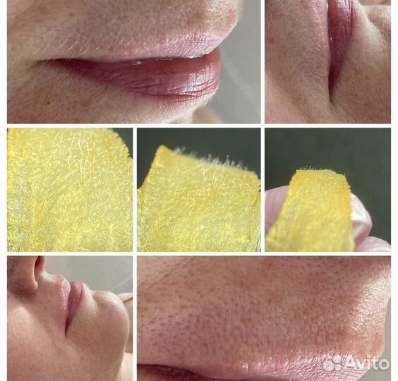 Бикини-дизайн