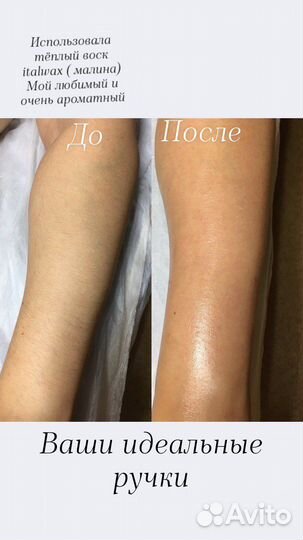 Восковая депиляция