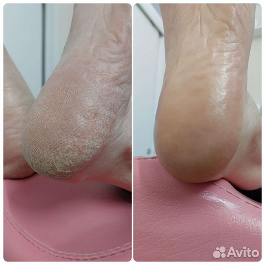 Smart педикюр