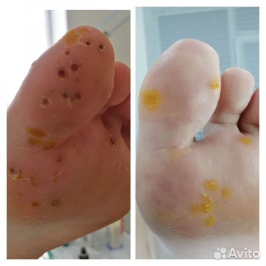 Услуги подолога