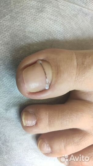 Подолог со стажем. Любые проблемы ног и рук