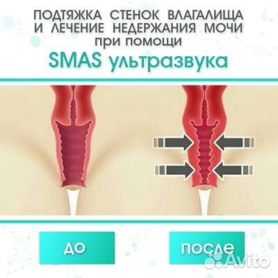 Косметолог чистка лица, пилинг лица