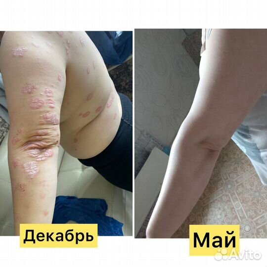 HemoHim иммунитет