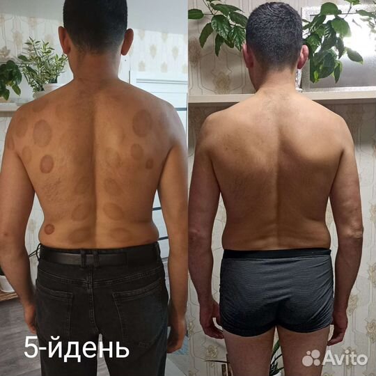 Массаж лица и тела(медицинское образование)