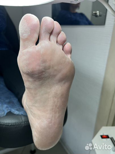 Ногти гель лак