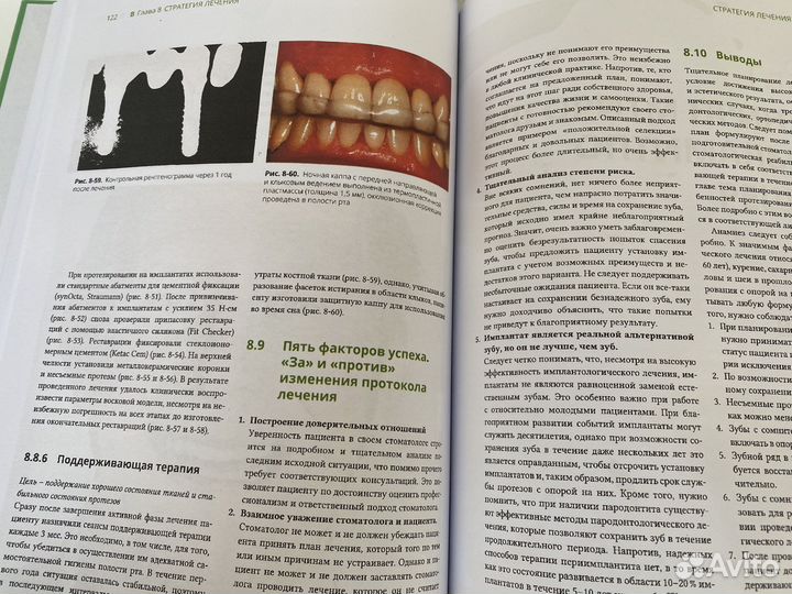 Протезирование с опорой на имплантаты