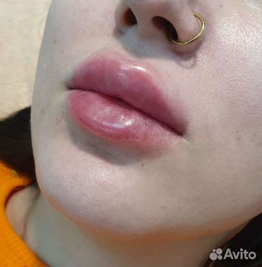 Косметолог чистка лица, пилинг лица