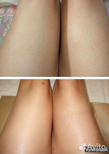 Мастер шугаринга