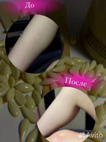 Восковая депиляция