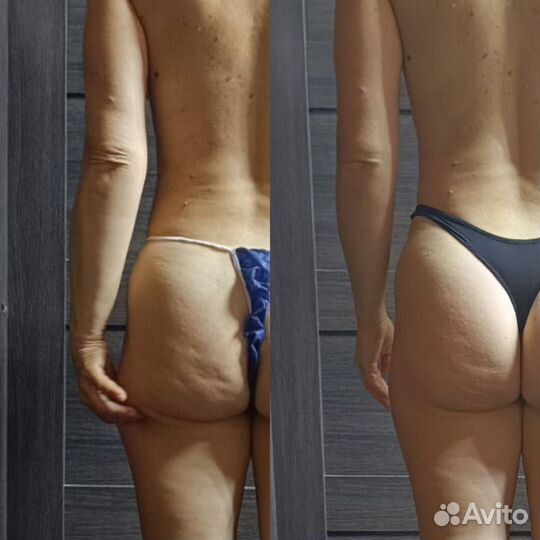 Массаж,парение в кедровой бочке