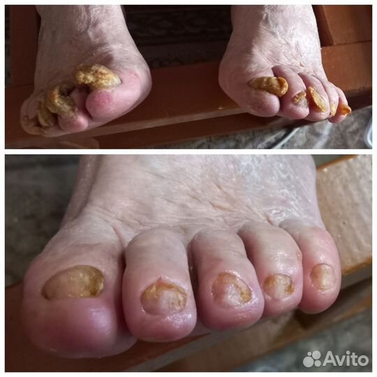 Маникюр и педикюр
