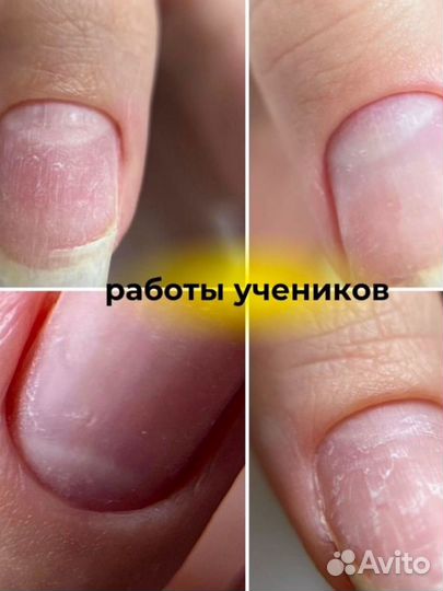 Курсы обучение маникюру, укрепление гелем