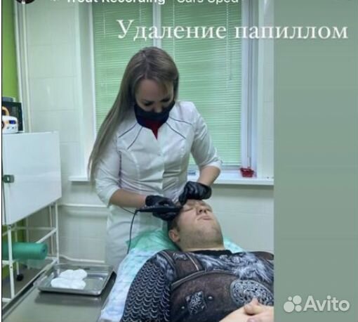 Удаление новообразований (папиллом)