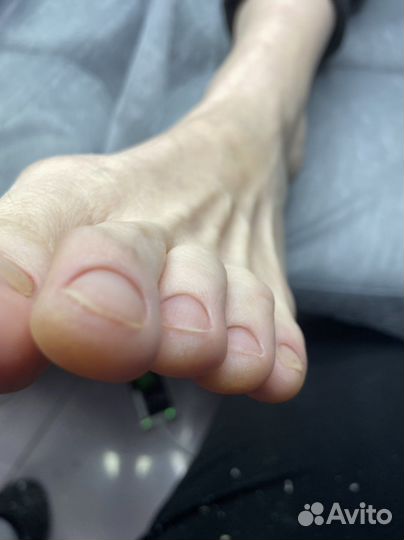 Подолог Елец Медицинский педикюр