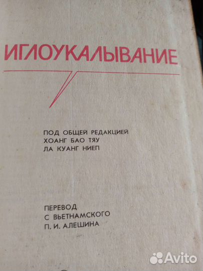 Иглоукалывание