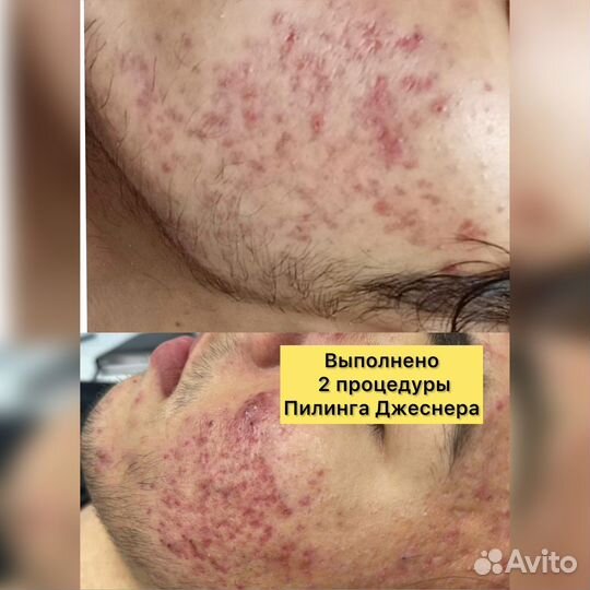 Мастер по наращиванию ресниц, косметолог