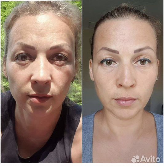 Скульптурно-моделирующий массаж лица