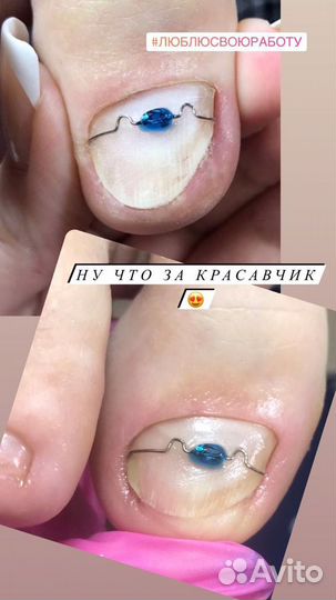 Маникюр, педикюр, подология