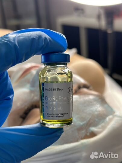 Карбокситерапия