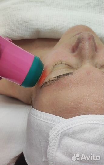 Аппаратное омоложение сфт