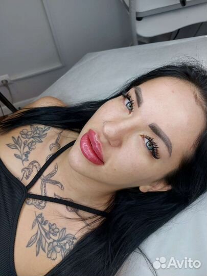 Увеличение губ,косметолог, ботокс