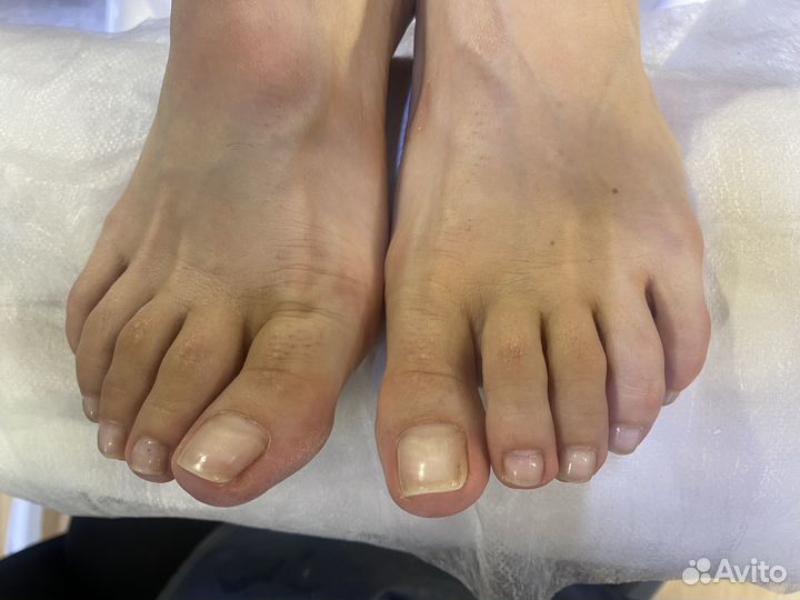 Ищу можель на педикюр без покрытия