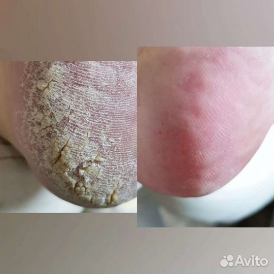 Педикюр/Маникюр/Аэрография/Брови Мехзавод