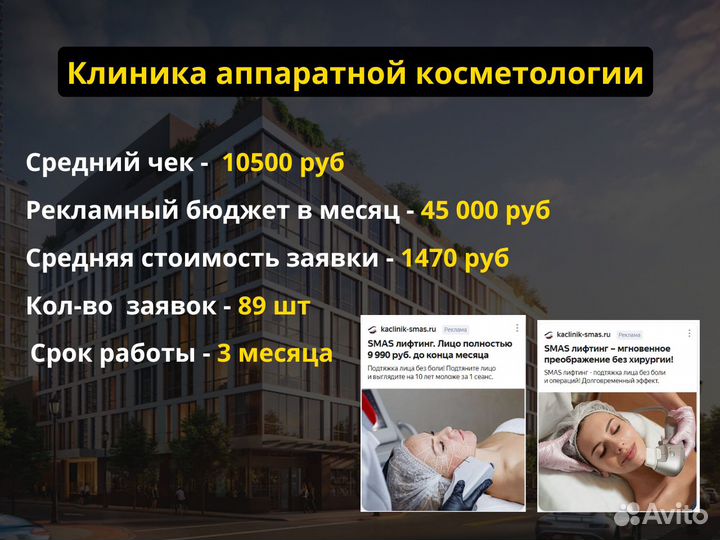 Настройка Яндекс Директ / Директолог