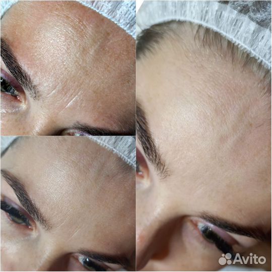 Косметолог эстетист микротоки