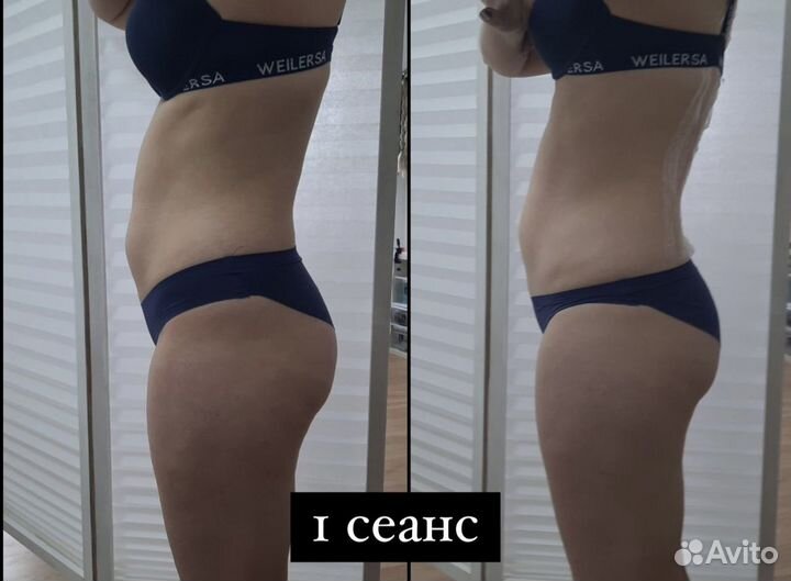 Биоэнергомассаж