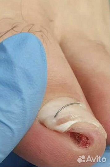 Педикюр, подолог