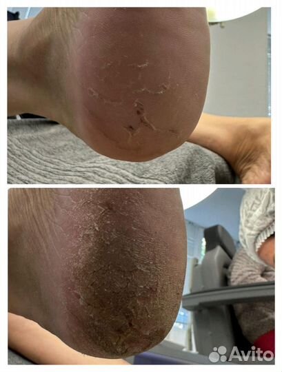 Услуги подолога