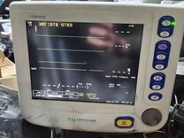 Монитор пациента 8100E nGenuity