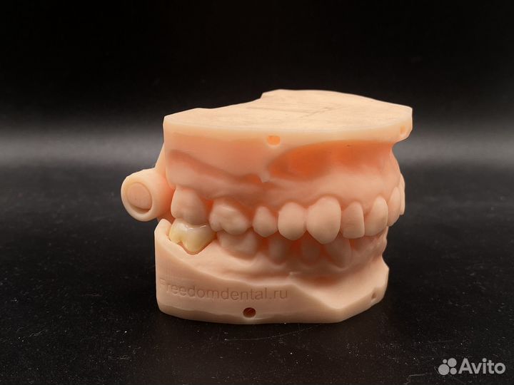 Коронка циркониевая/ e-max наготово по интраоральн