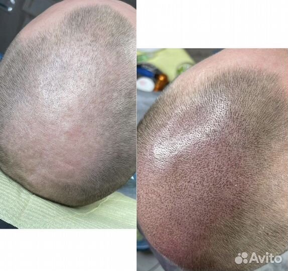 Перманентный камуфляж