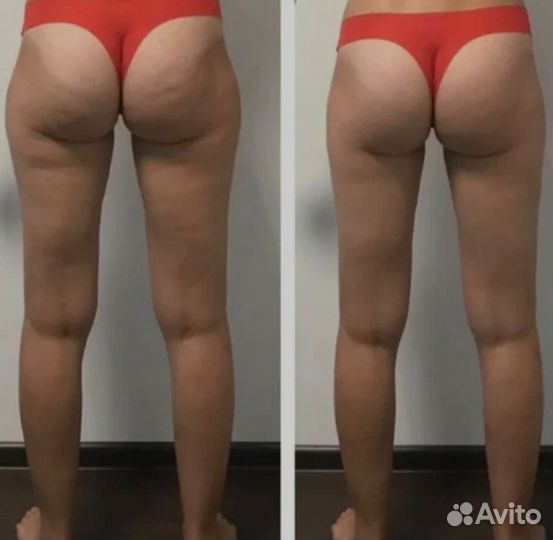 Инъекционная, аппаратная косметология