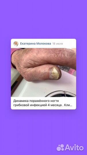 Подолог педикюр