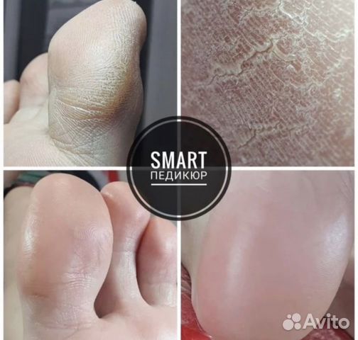 Педикюр