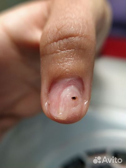 Услуги подолога