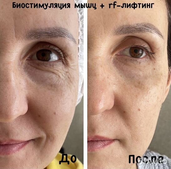 Услуги косметолога