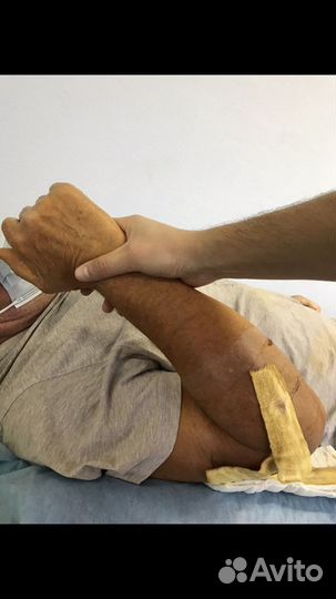 Реабилитация, Лфк, Аренда Миостимулятора(Compex)