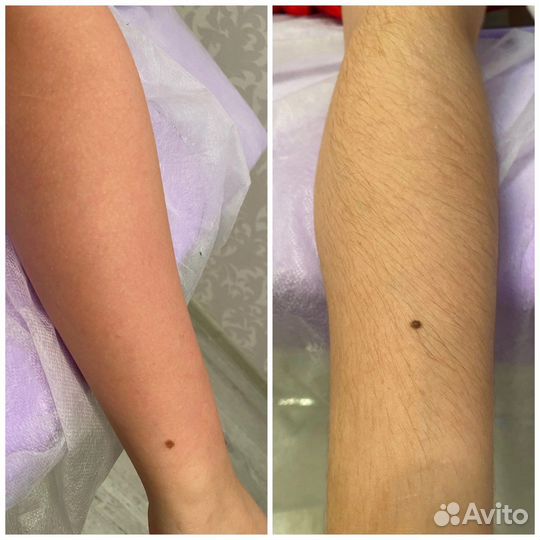 Восковая депиляция,шугаринг