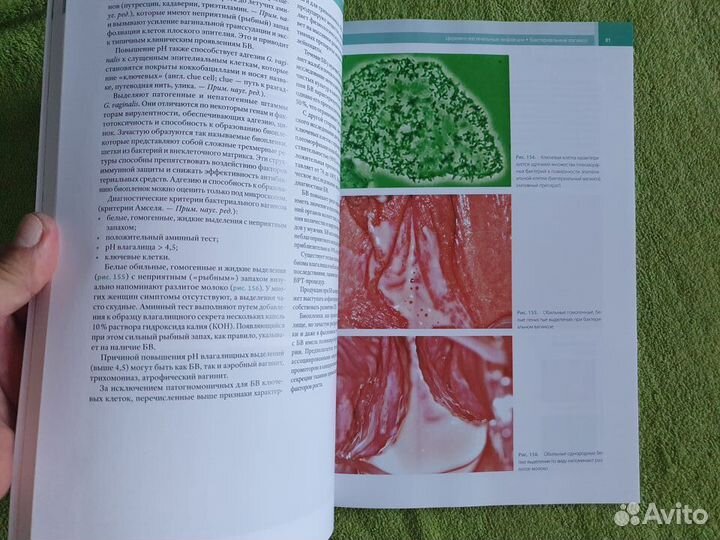 Кольпоскопия в деталях Дж. Минелло