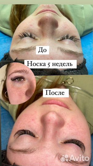 Наращивание ресниц