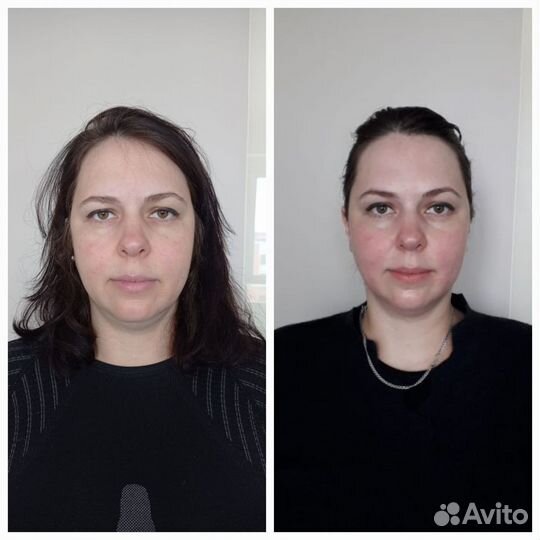 Массаж лица